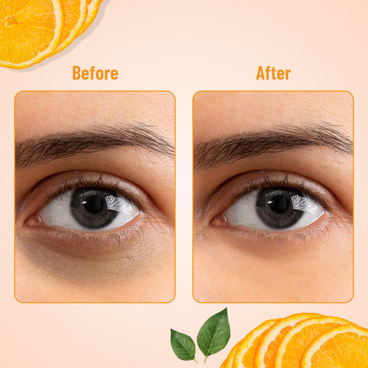 Swiss Beauty Hydra Eye Serum Patch with Vitamin C